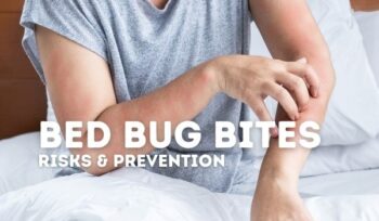 itching skin from bed bug bites